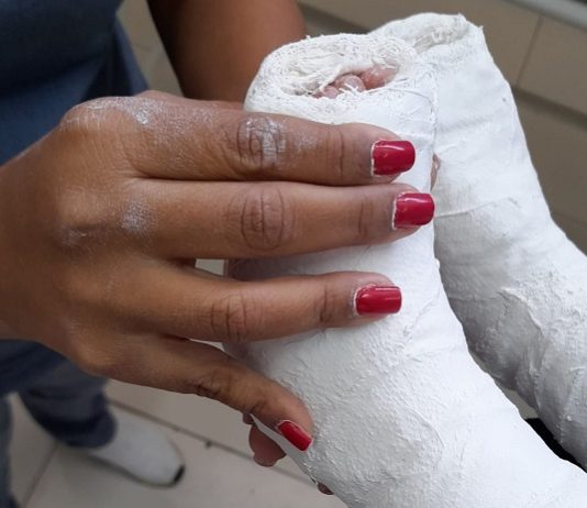 Hospital de Clínicas inicia consultas para cirurgias ortopédicas pelo Opera Paraíba