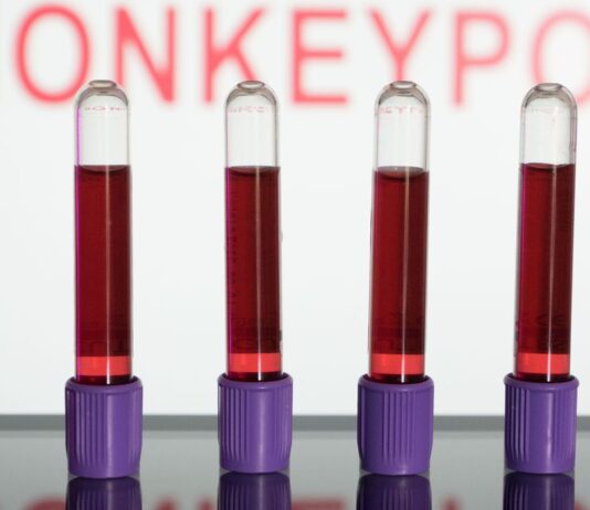 Primeiras vacinas contra varíola dos macacos devem chegar em setembro Doses serão para profissionais de saúde e quem teve contato com doente