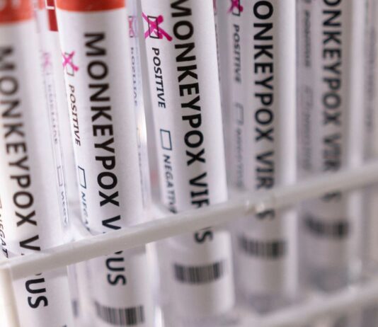 Varíola dos macacos: com 813 casos, Brasil tem situação “preocupante” É o que diz a Organização Mundial da Saúde