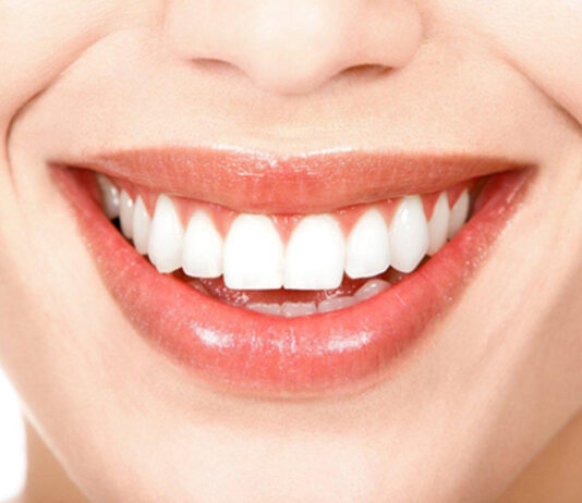 Má alimentação tem impacto na saúde bucal