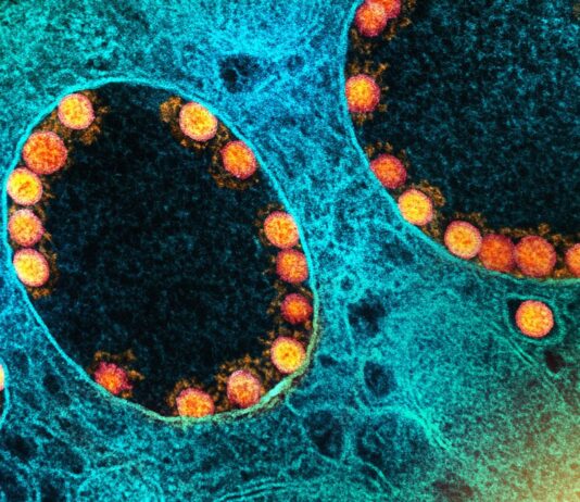 Covid-19: Brasil tem 8.289 mortes confirmadas nas últimas 24 horas. No mesmo período foram registradas 46 mortes
