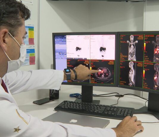 Câncer de próstata tem novo tratamento com radioterapia reduzida. Novembro Azul alerta sobre a importância do diagnóstico precoce