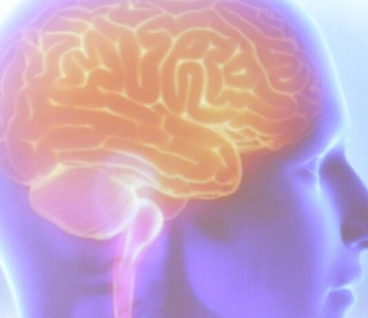 Organização Mundial do AVC alerta que 90% dos derrames são preveníveis. Doença é uma das maiores causas de morte e incapacidade